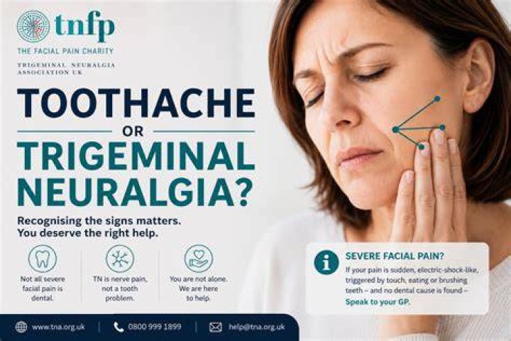 Can trigeminal neuralgia feel like a toothache?