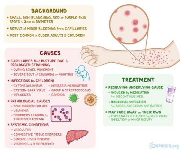 Can vomiting cause petechiae?