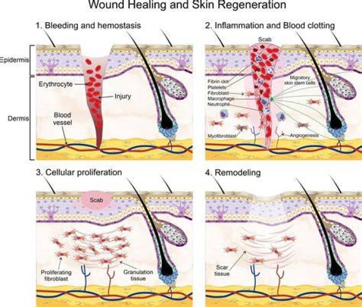 How does skin try to repair itself when the epidermis is slightly injured?
