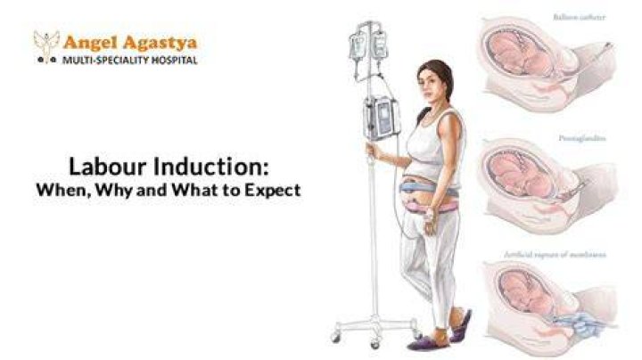 How is induced labor done?