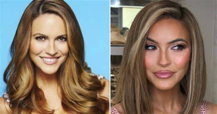 Reddit: Selling Sunset Cast Before and After Plastic Surgery!