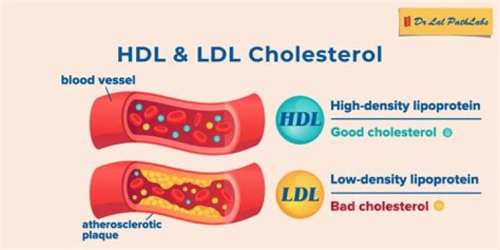 What causes high LDL and HDL?
