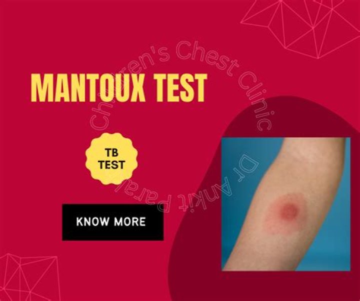 What drug is Mantoux test?