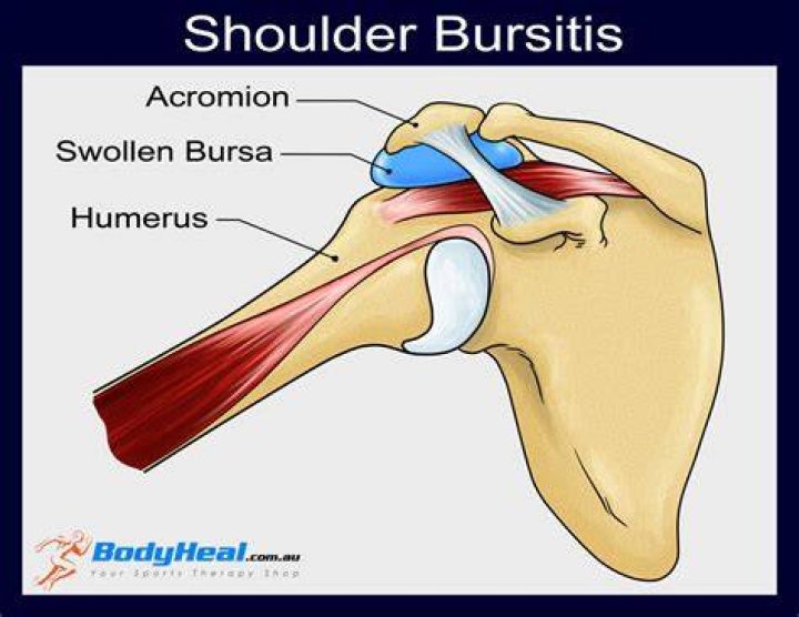 What is Bursa made of?