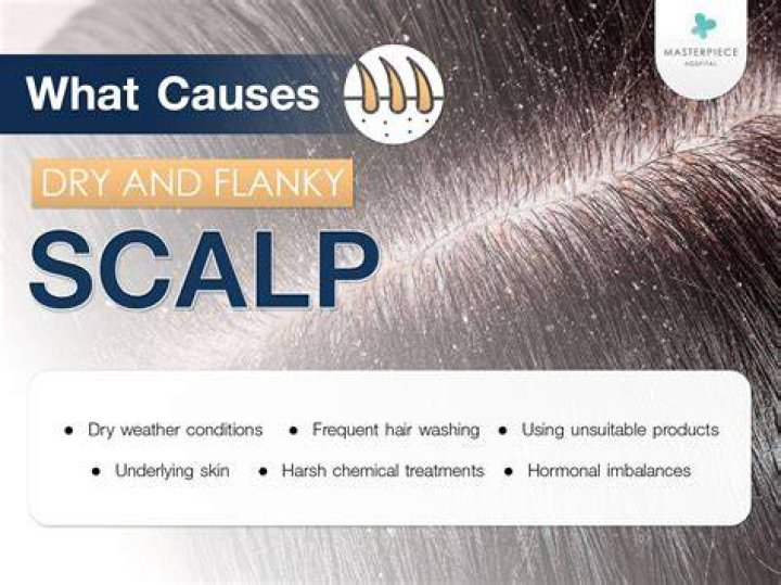 What is dry scalp a sign of?