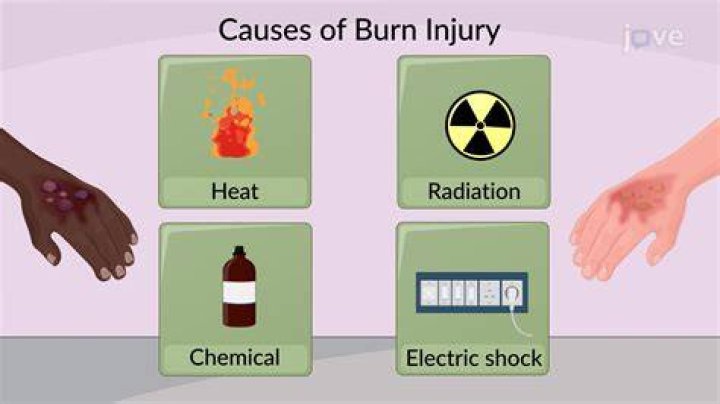 What type of burns are caused by caustic substances?