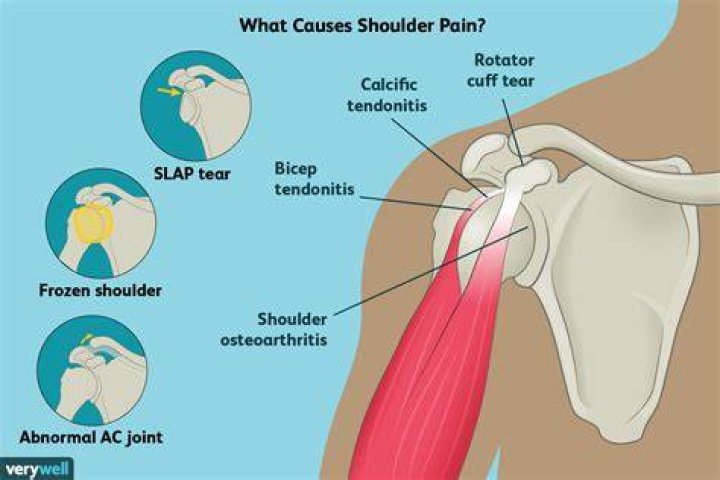 Why is the shoulder joint a weaker joint?